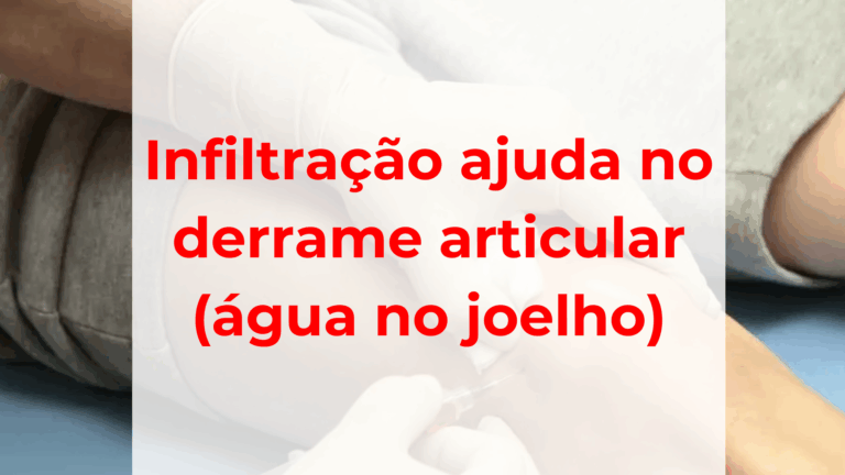 infiltraçao articular para água no joelho derrame articular