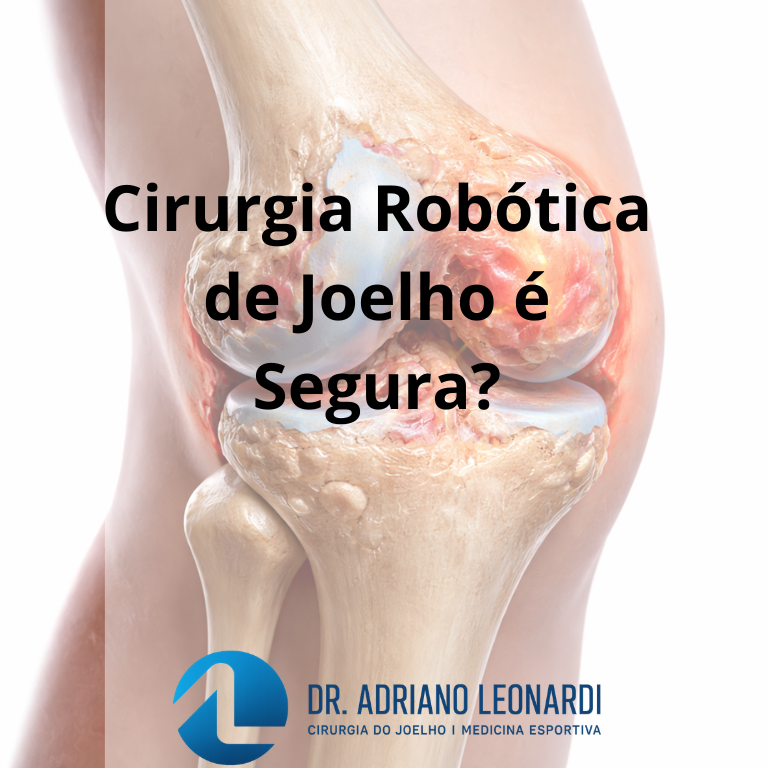 Cirurgia Robótica de Joelho é Segura?