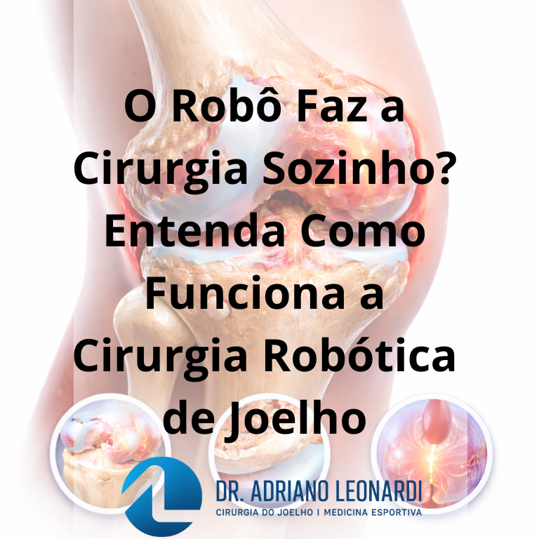cirurgia robótica de joelho