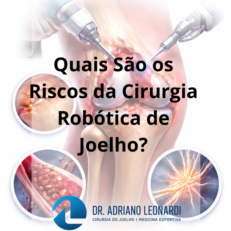 cirurgia robótica de joelho