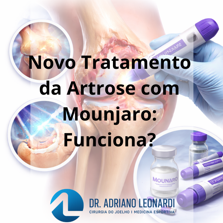 Novo Tratamento da Artrose com Mounjaro: Funciona?