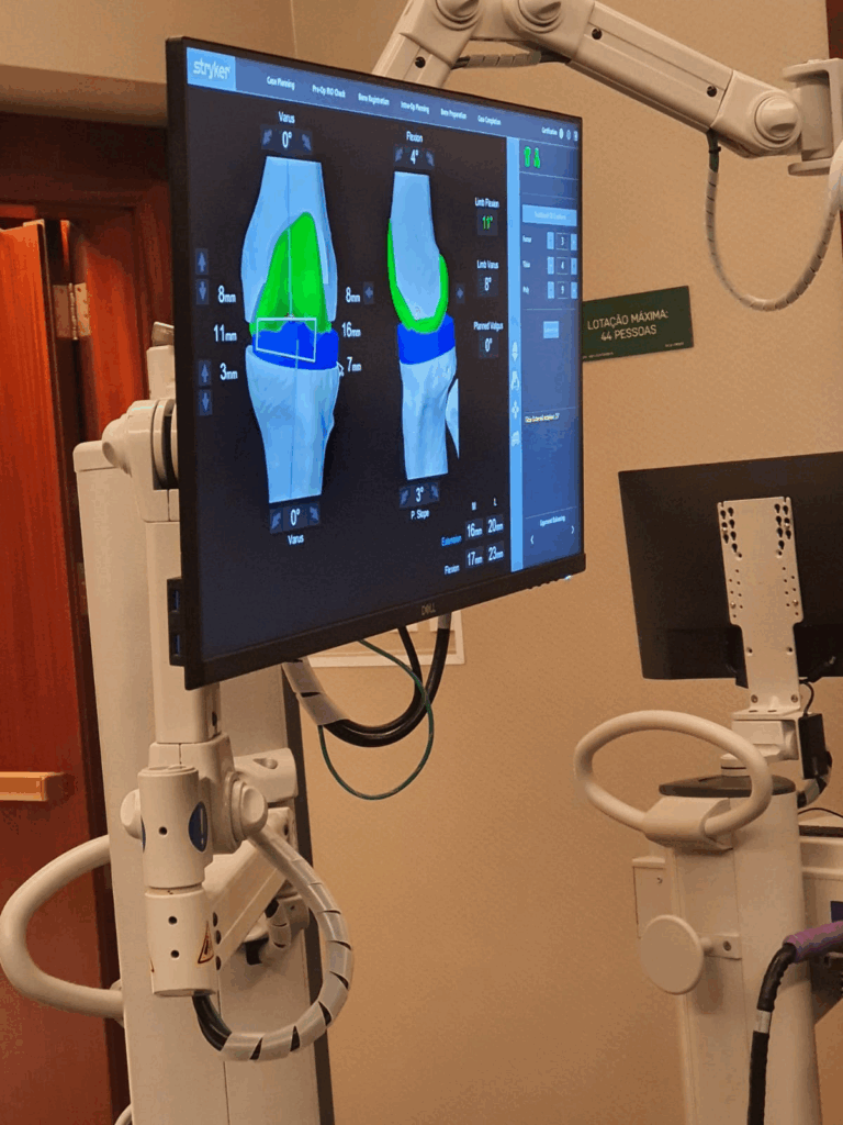 O Robô Faz a Cirurgia Sozinho? Entenda Como Funciona a Cirurgia Robótica de Joelho