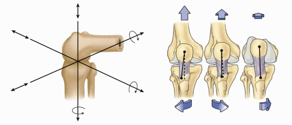Cirurgia Robótica de Prótese de Joelho é Mais Precisa?