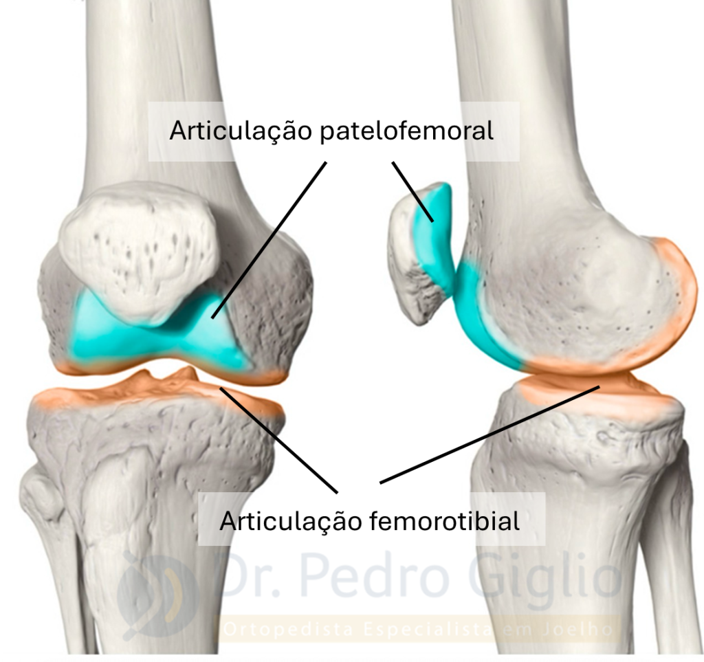 condromalácia patelar