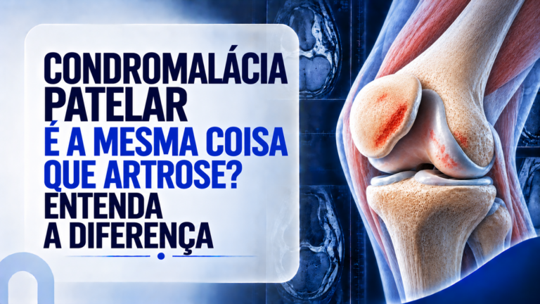 Condromalácia Patelar